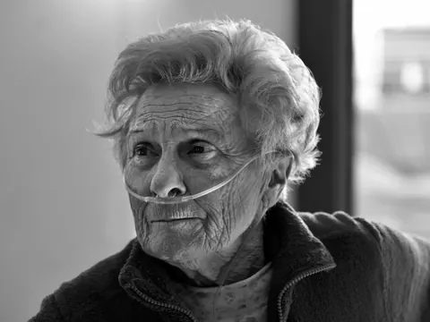 An older woman with a nasal oxygen tube