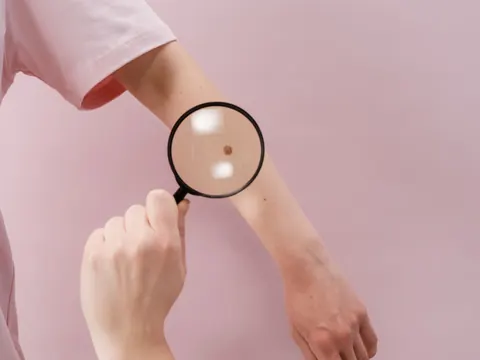 Skin checked with a magnifying glass